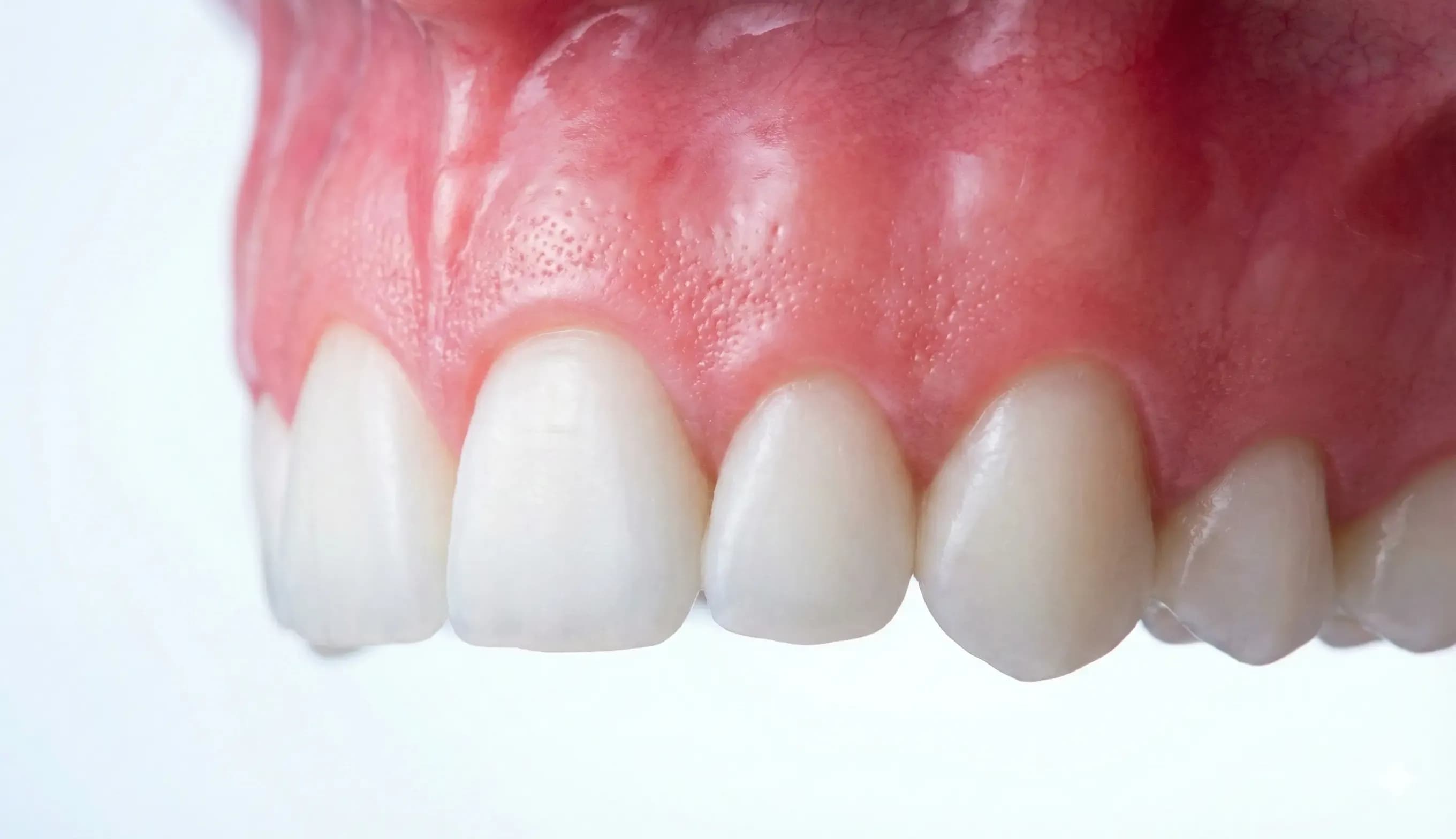 Periodontoloji (Diş Eti Hastalıkları)