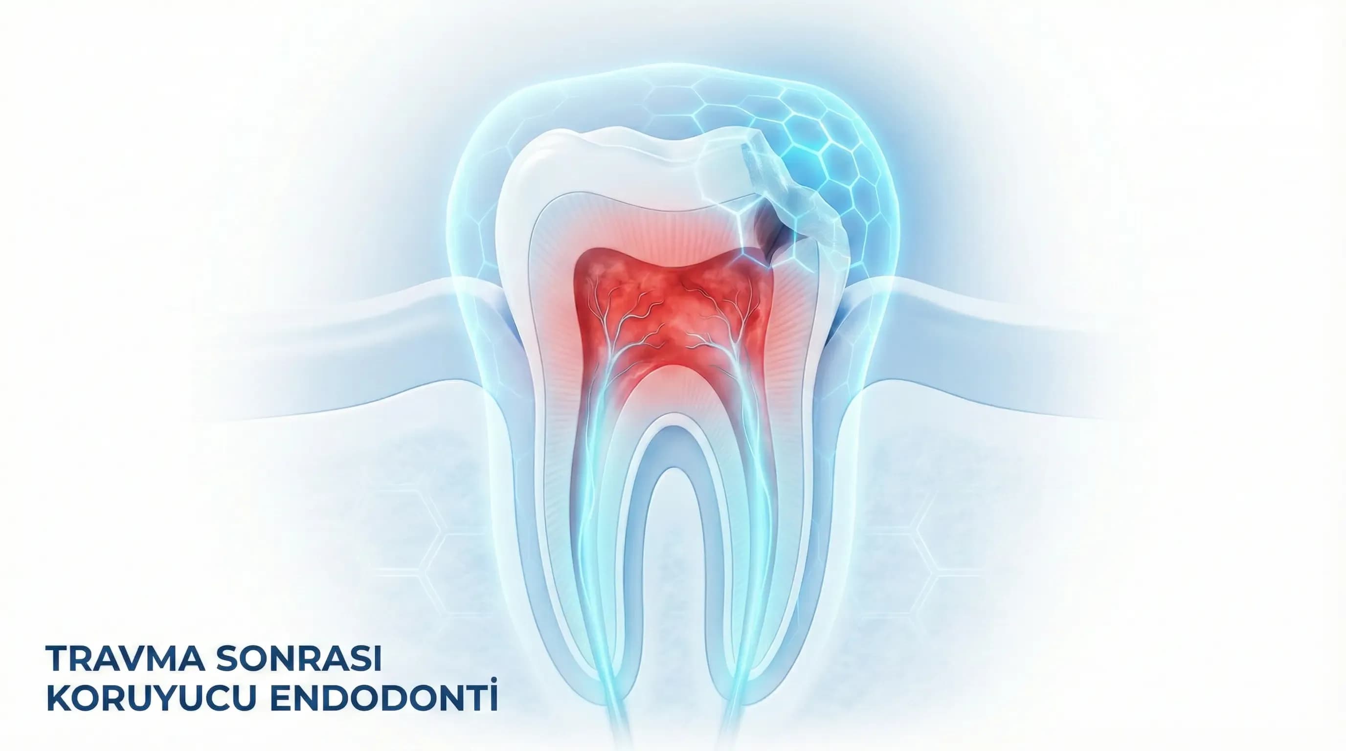 Travma Sonrası Diş Tedavisi - Mercan Diş Ereğli